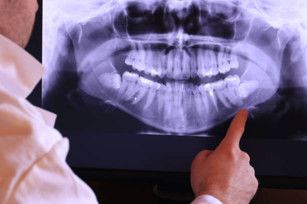 Best Emergency Tooth Extraction in Highland Park, MI