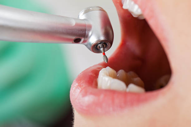 Best Emergency Root Canal Treatment in Highland Park, MI